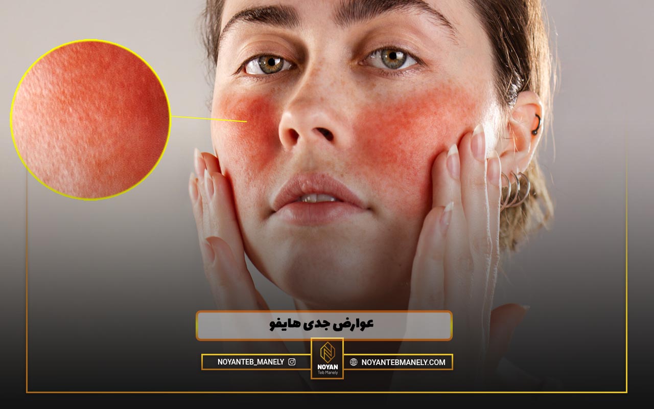 آیا هایفو عوارض دارد ؟