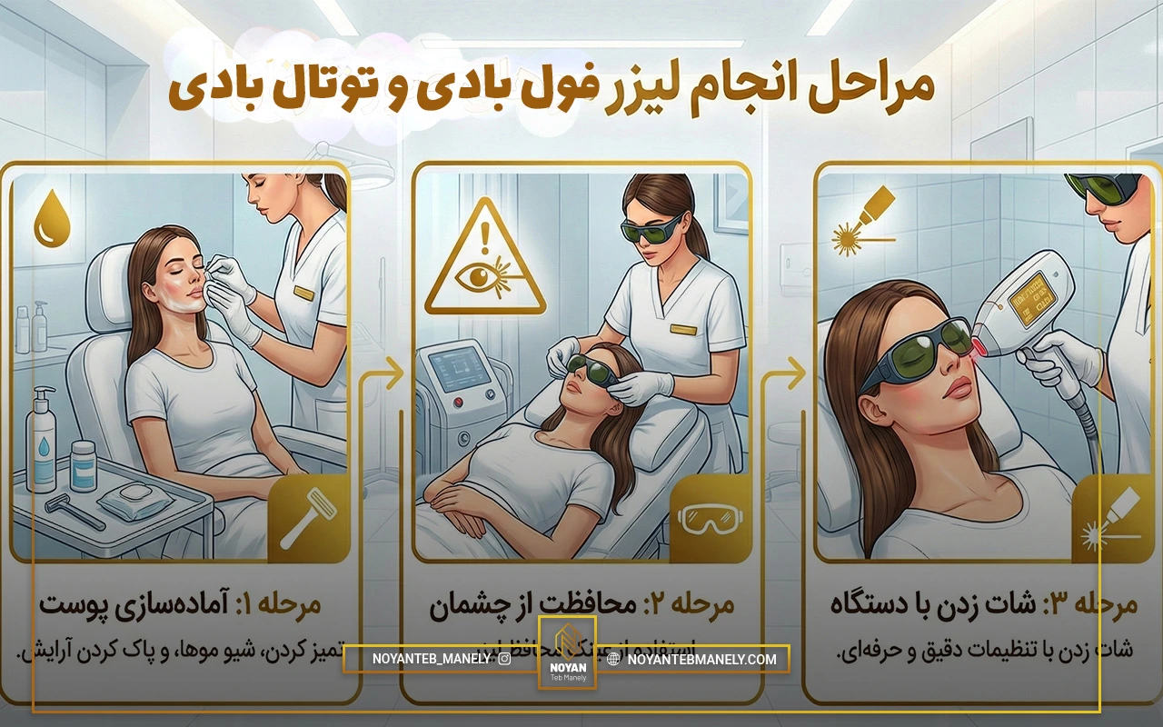 مراحل لیزر فول بادی چیست؟