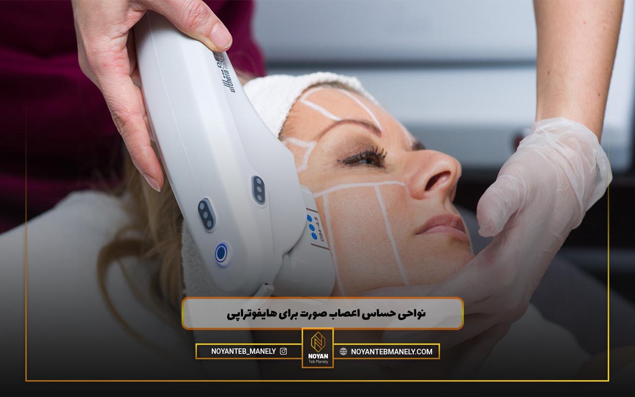 نواحی حساس اعصاب صورت در هایفوتراپی