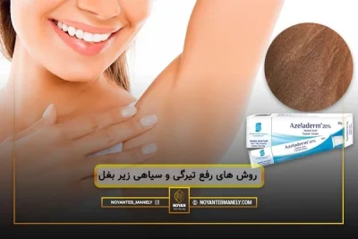 رفع تیرگی زیر بغل