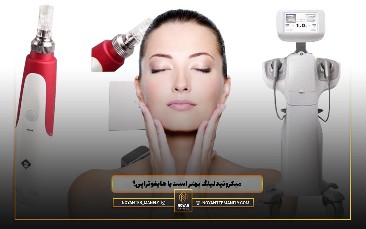 هایفوتراپی بهتره یا میکرونیدلینگ ؟