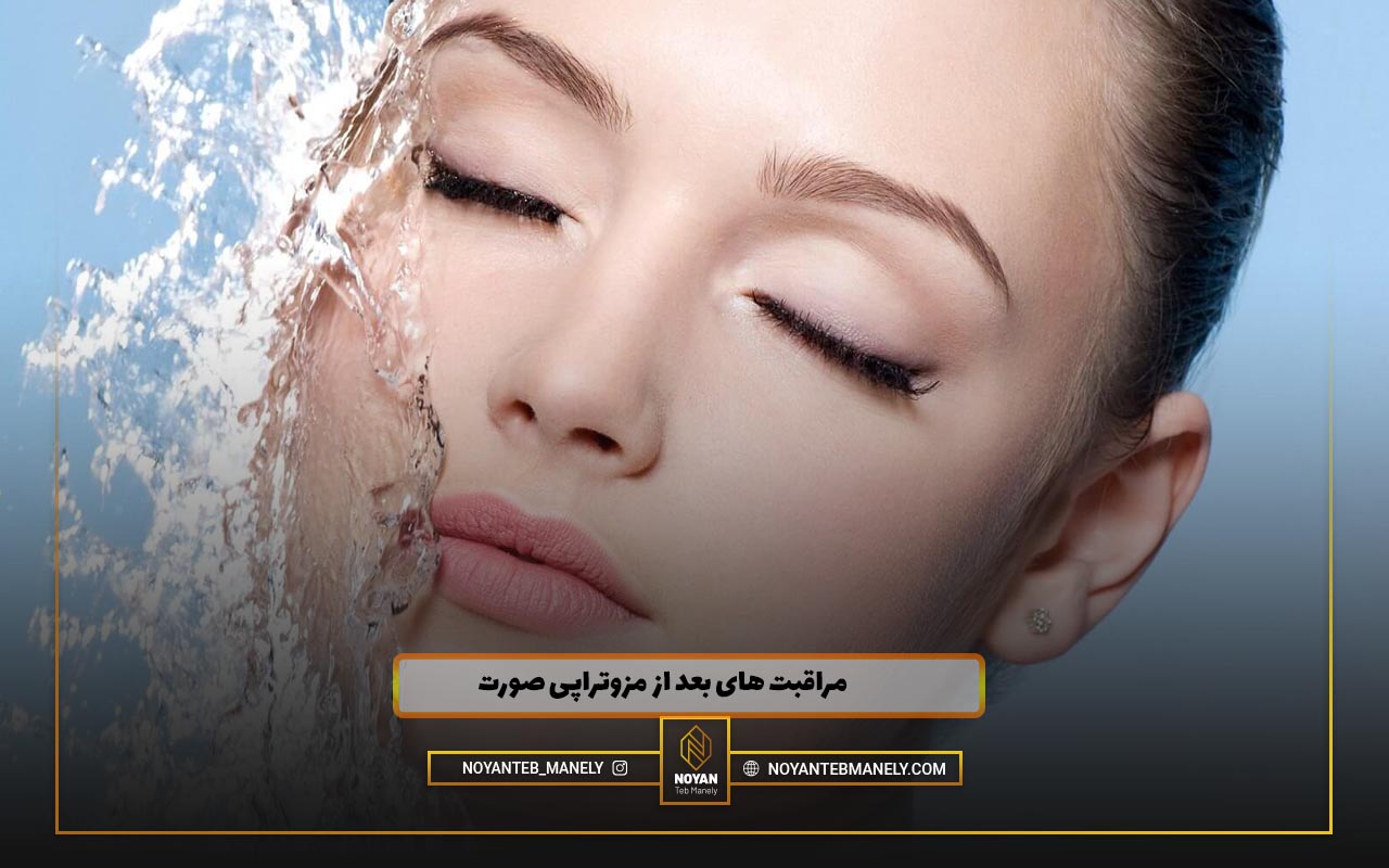 مزوتراپی لک صورت نی نی سایت