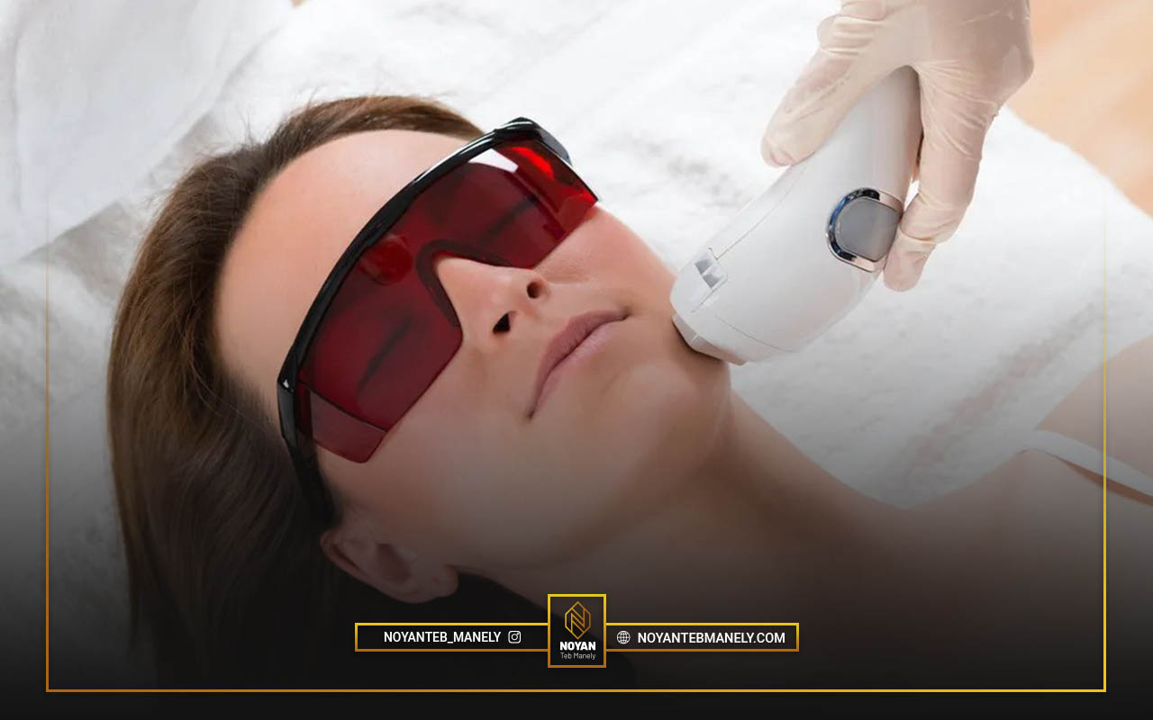 دلایل رشد مجدد موهای زائد بعد از لیزر