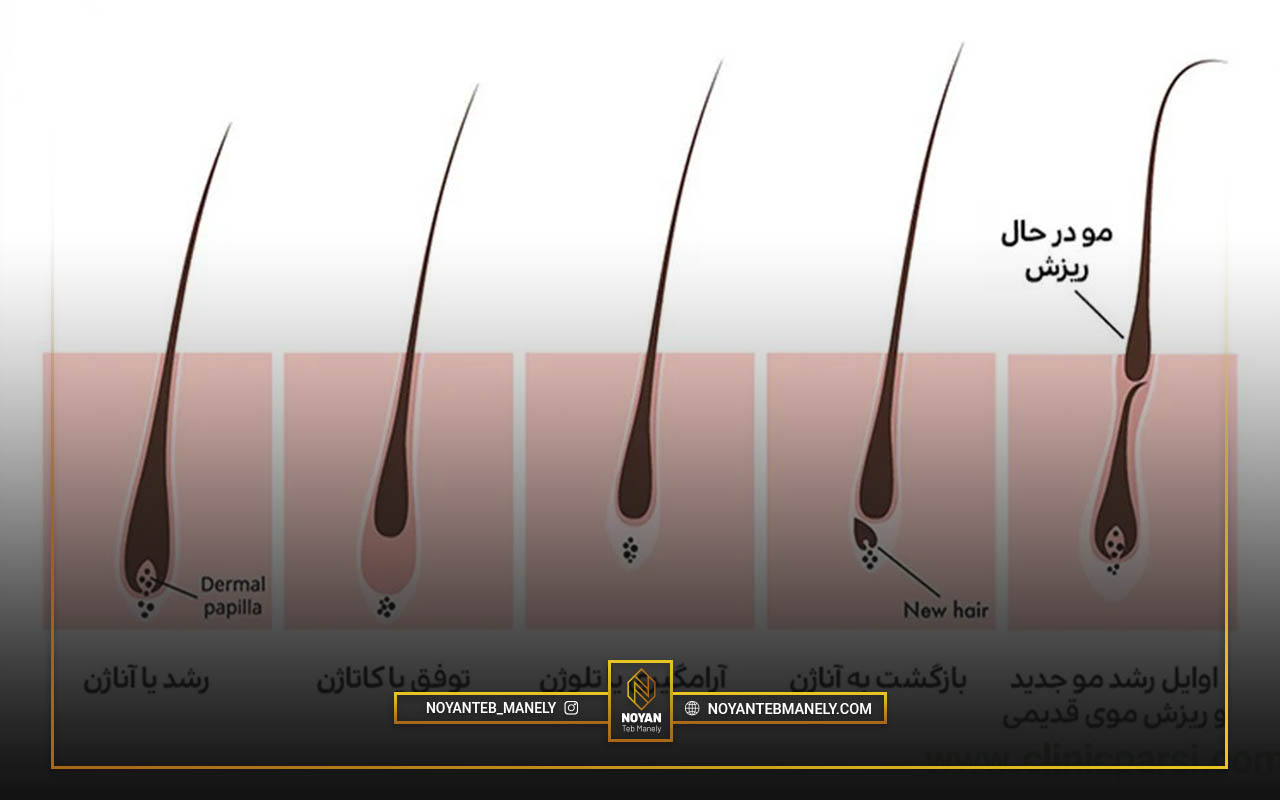 علت برگشت موهای زائد بعد از لیزر