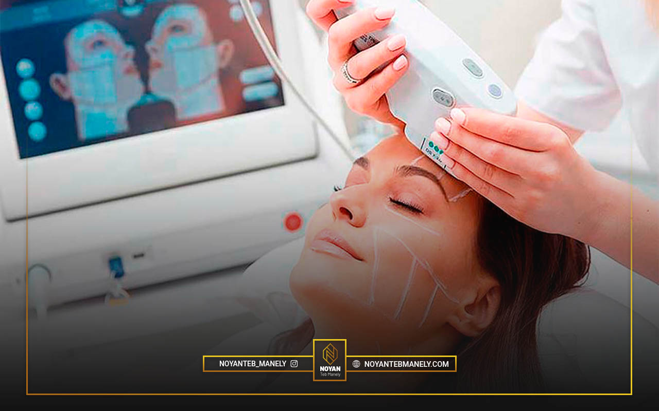 دوره هایفوتراپی صورت