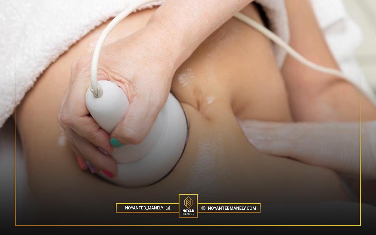 مقایسه دستگاه لاغری جی فایو با دستگاه لاغری آر اف کویتیشن