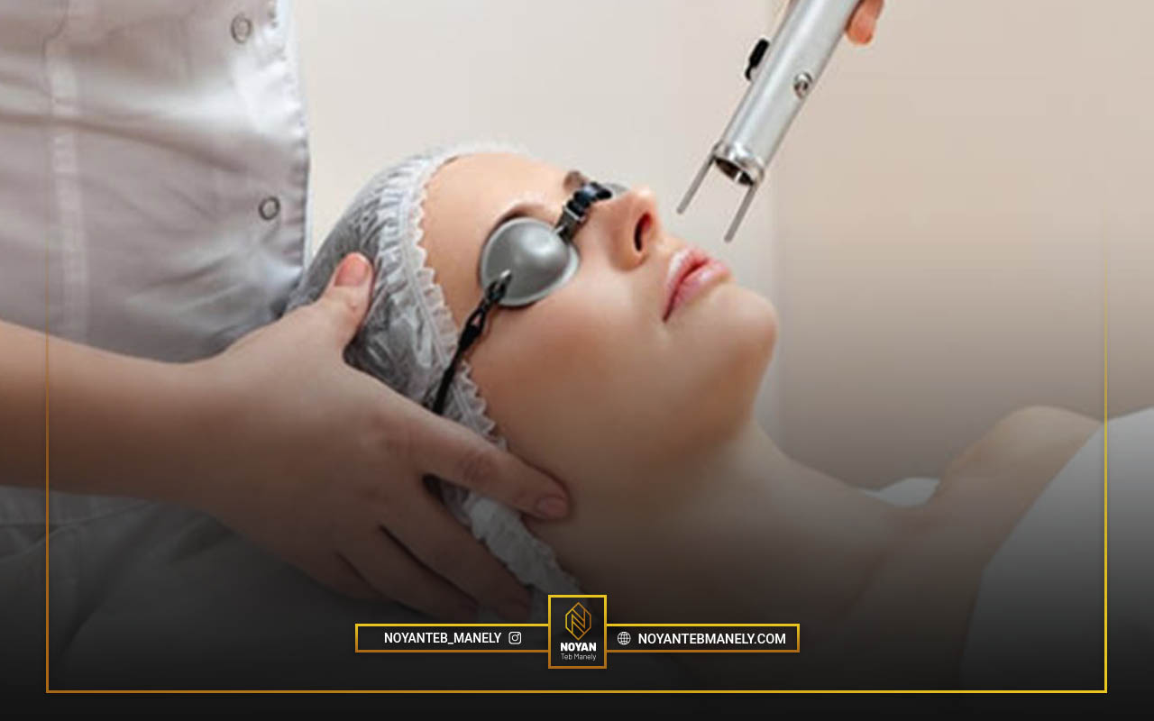 هزینه جلسات درمان لیزر CO2 فرکشنال