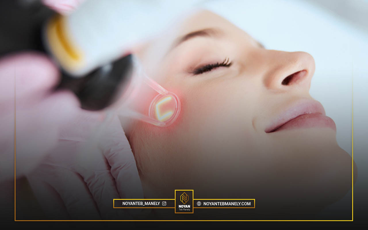 هزینه درمان با لیزر CO2 فرکشنال