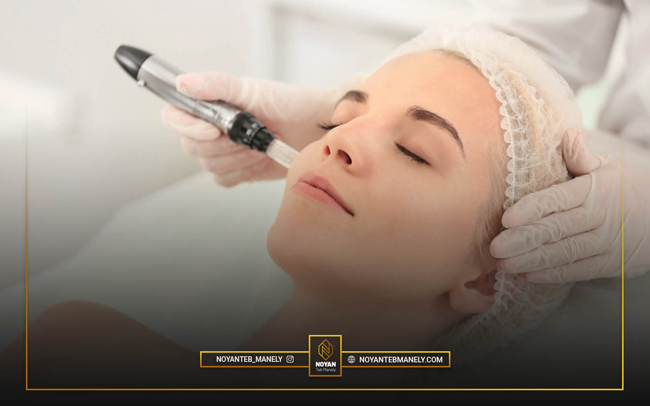 دوره نقاهت لیفت پوست با آر اف فرکشنال