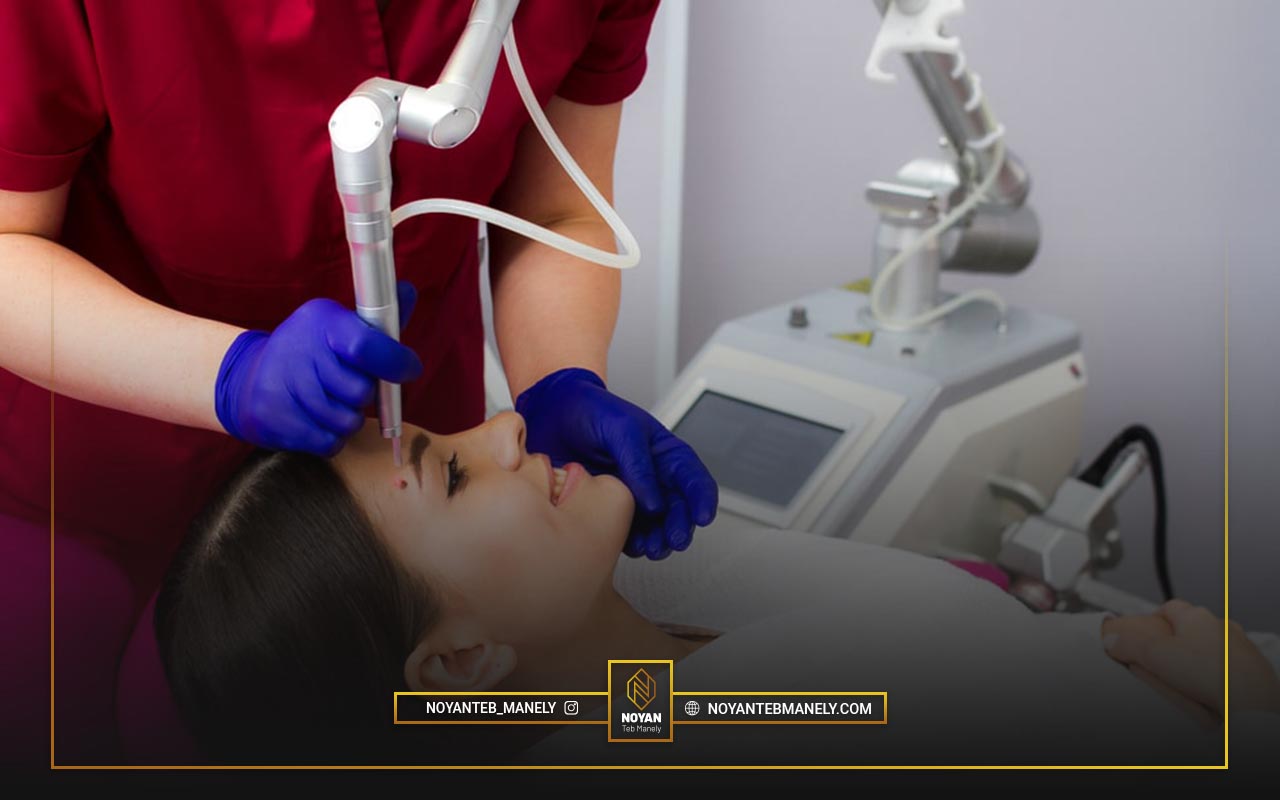 فناوری پیکوسکند چیست؟