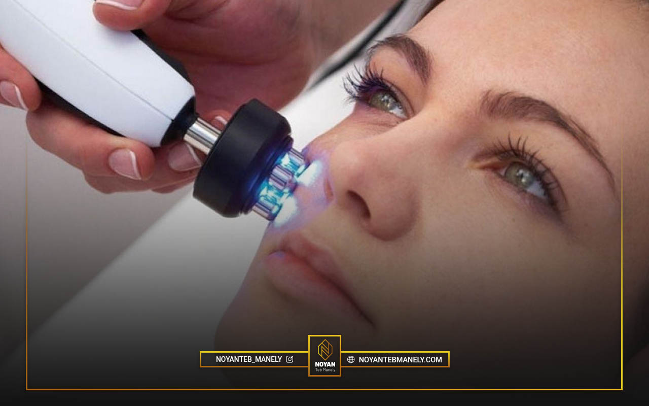 لیزر CO2 فرکشنال بهتر است یا RF فرکشنال؟