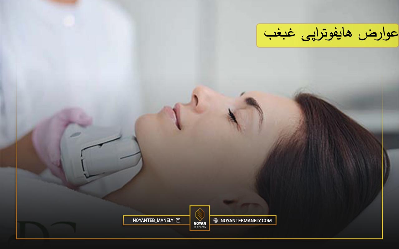 عوارض هایفوتراپی غبغب چیست؟
