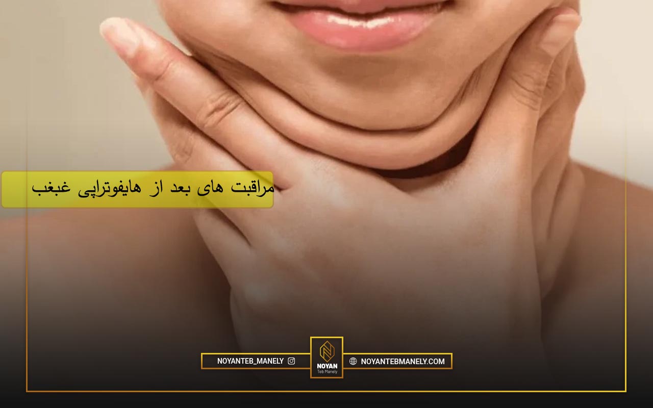 قیمت هایفوتراپی غبغب