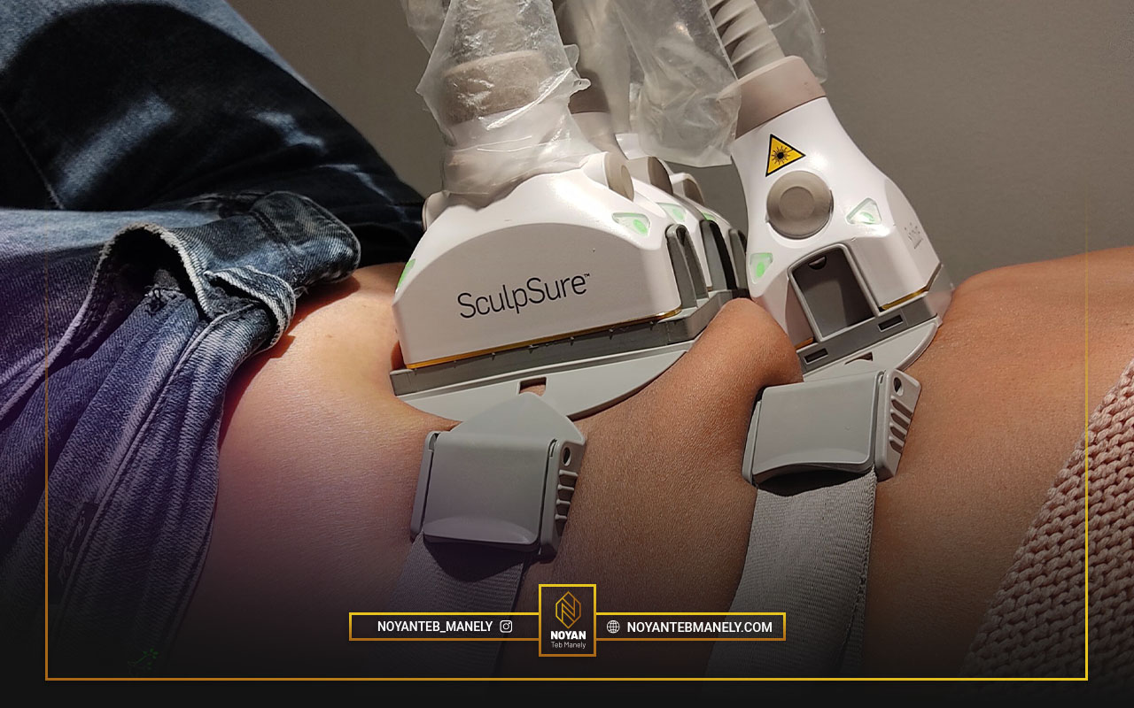 لاغری سریع اسکالپشور