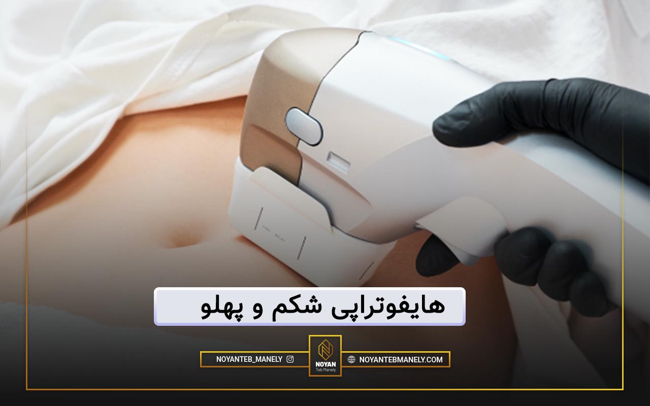 هایفوتراپی شکم چیست؟