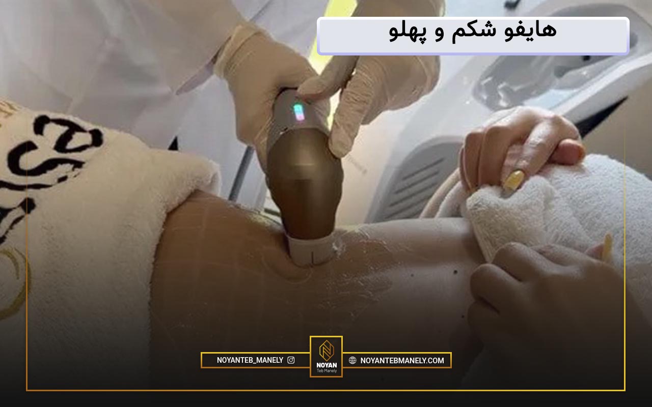 هایفو شکم و پهلو