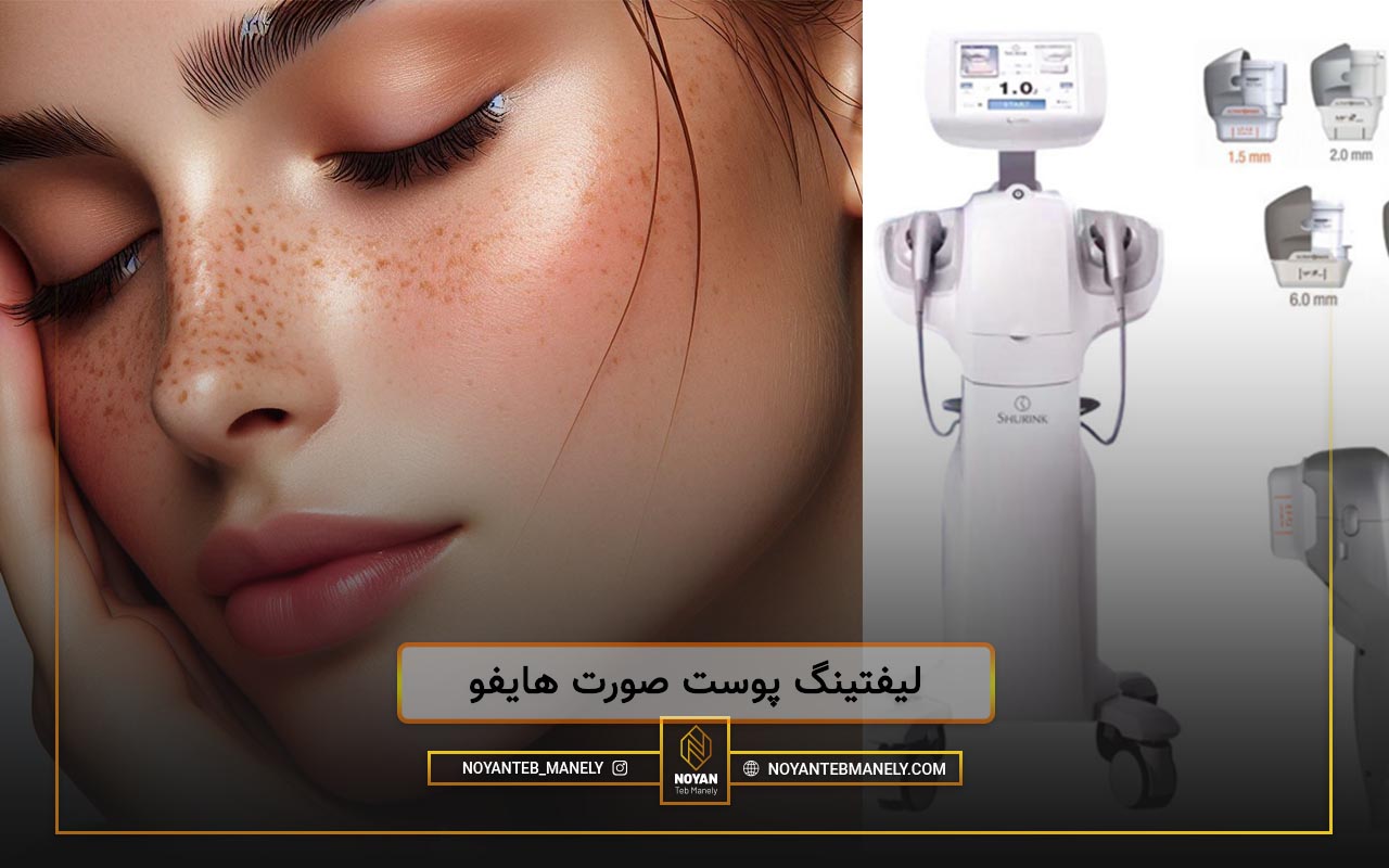 دستگاه هایفو صورت