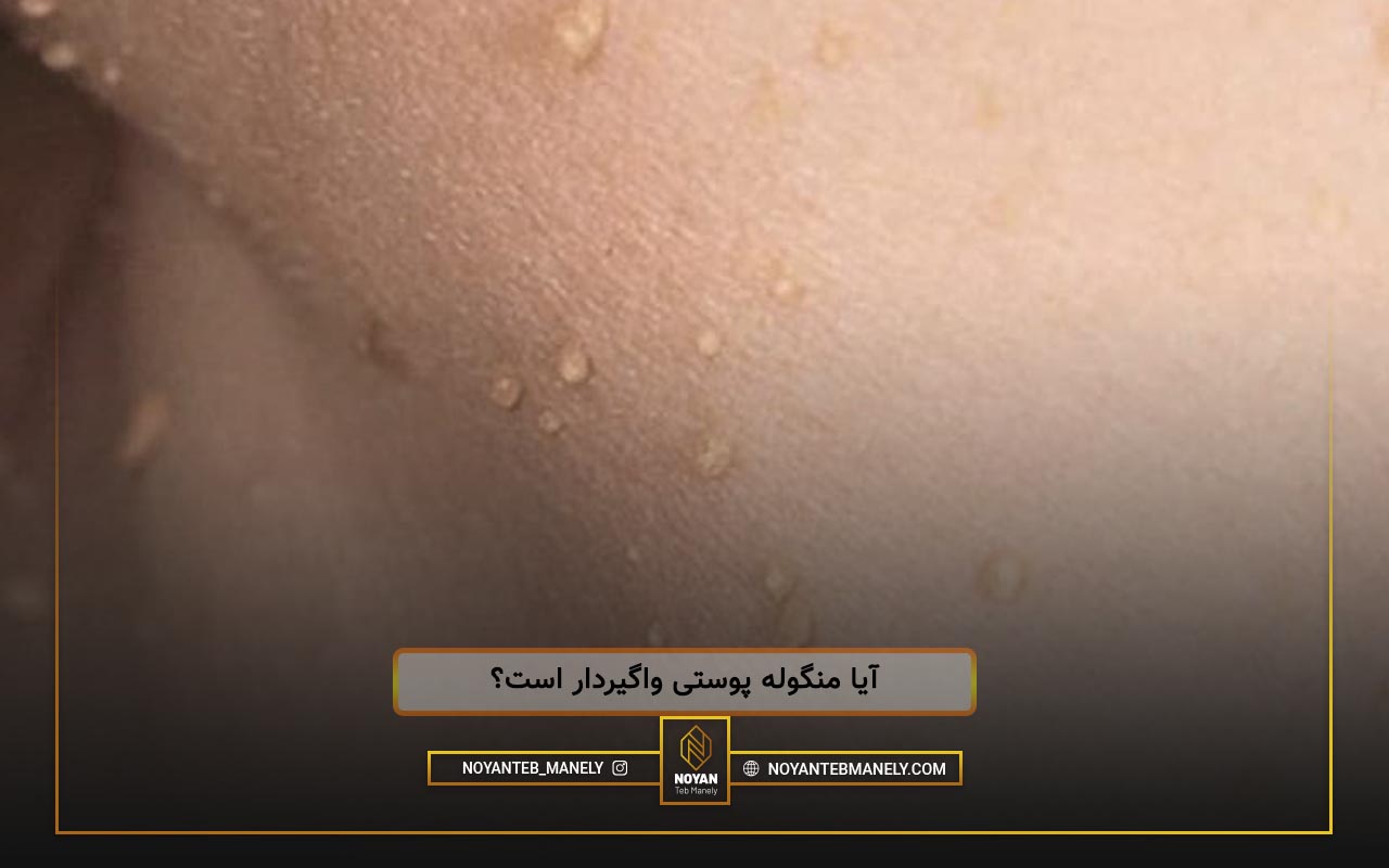 تفاوت اسکین تگ و زگیل تناسلی