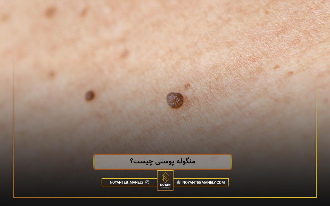 اسکین تگ چیست؟