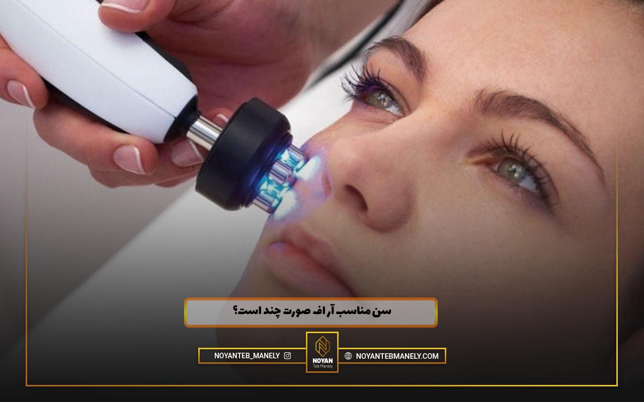 آر اف صورت چیست؟