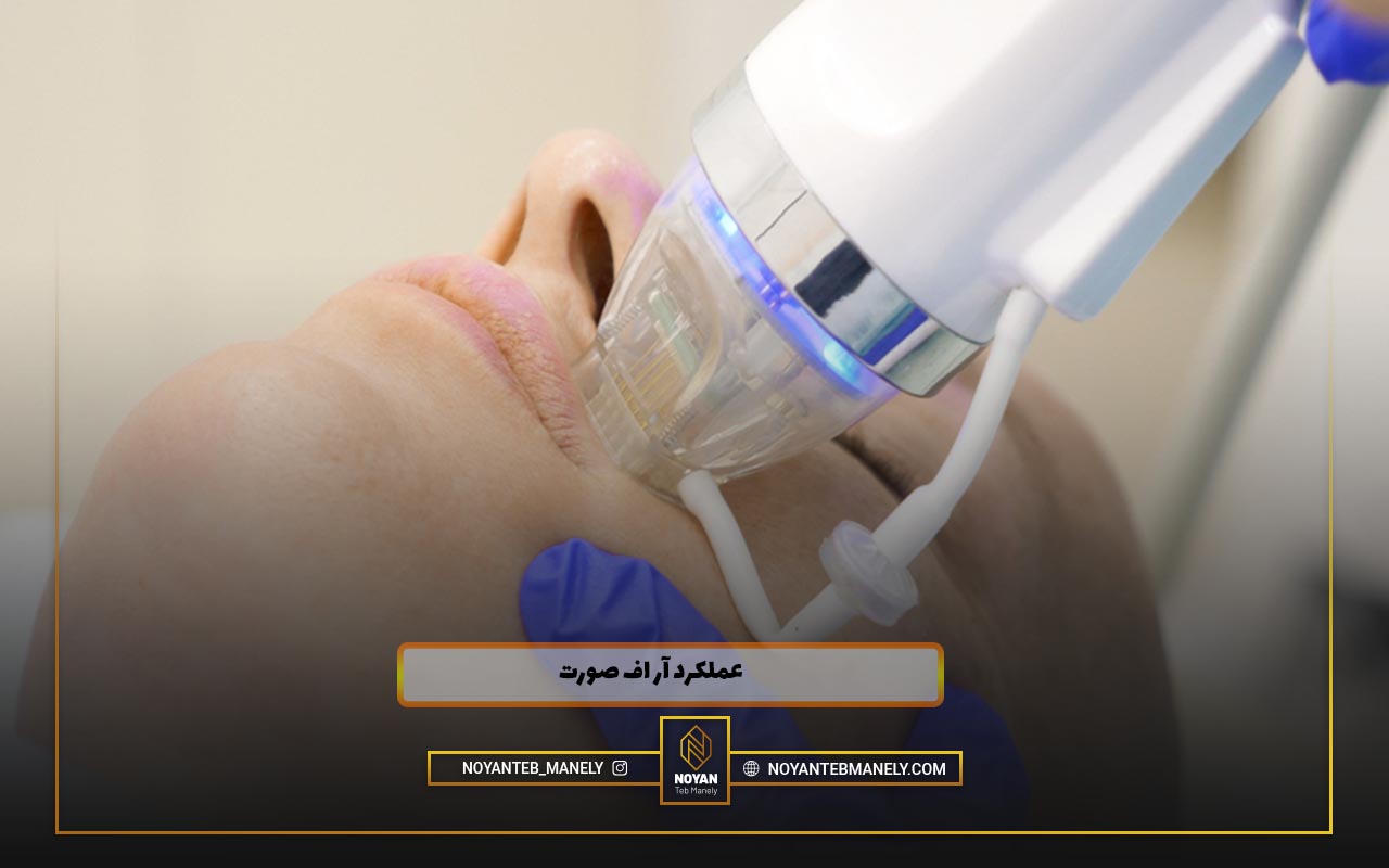 انواع آر اف برای صورت