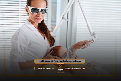 سریع ترین راه از بین بردن لک صورت با لیزر