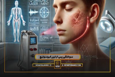 سوختگی پس از لیزر کیوسوئیچ
