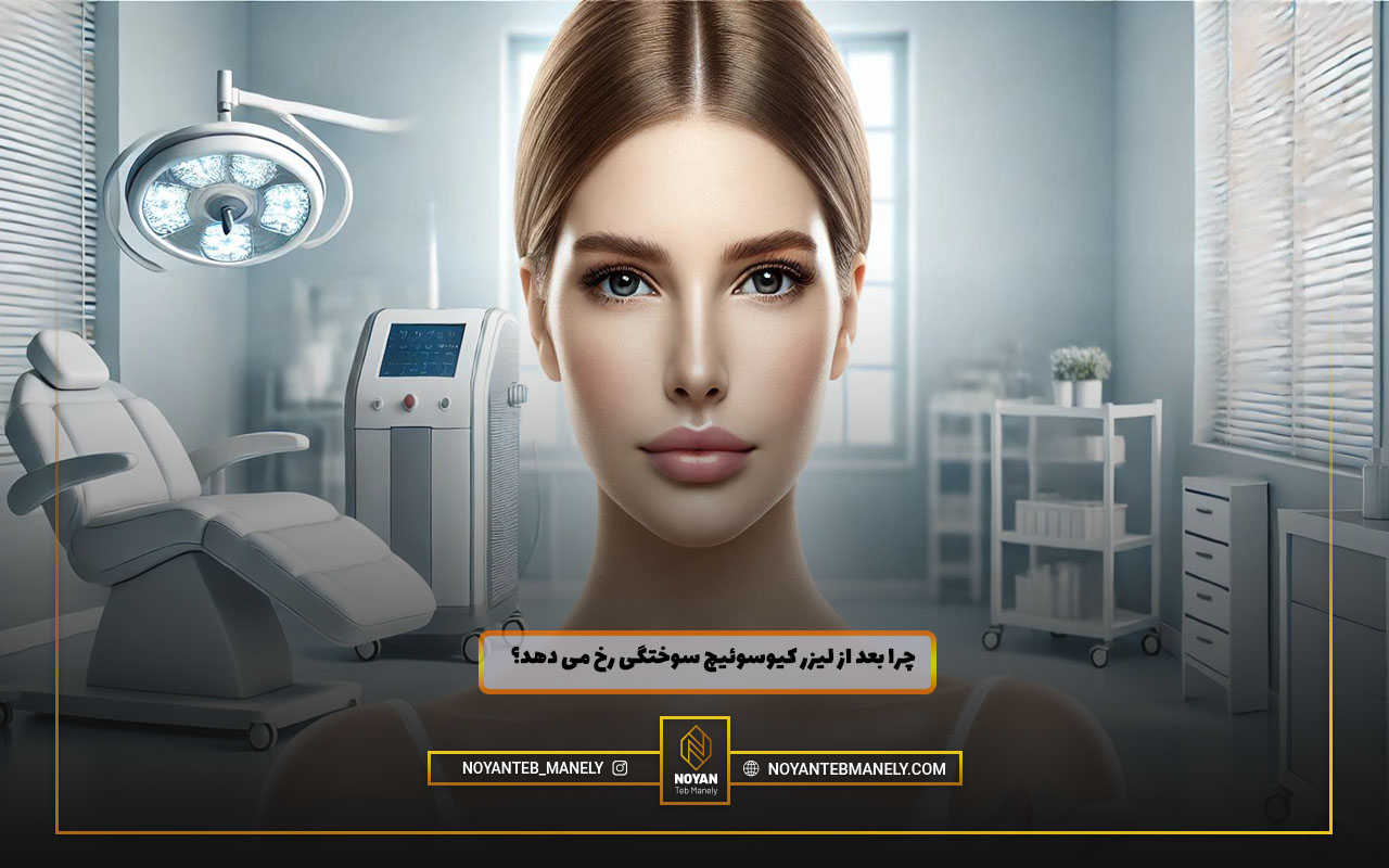 علت سوختگی بعد از لیزر کیوسوئیچ