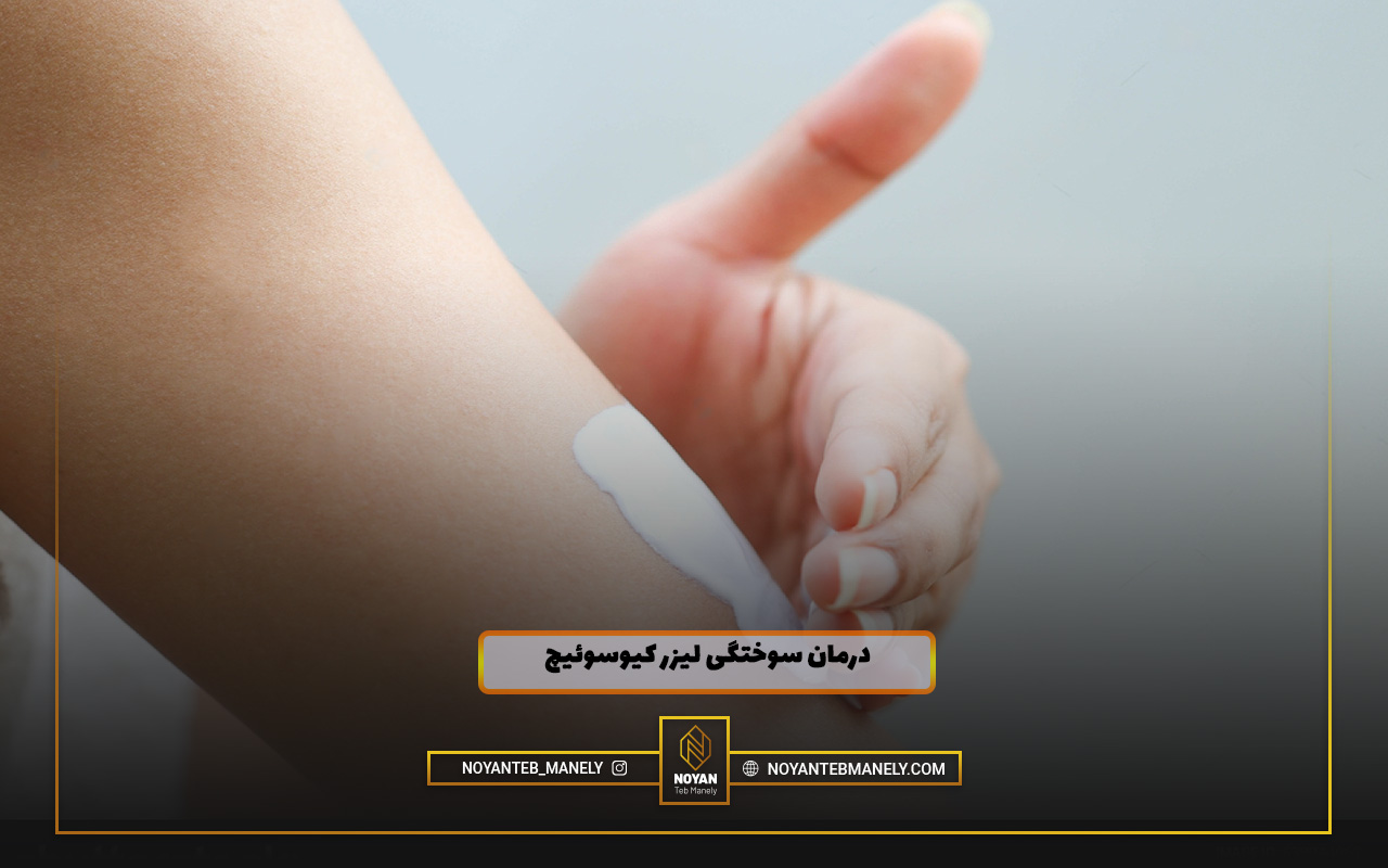 درمان سوختگی لیزر کیوسوئیچ